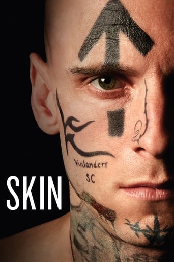 Skin - Film completo in Altadefinizione Skin streaming in alta definizione